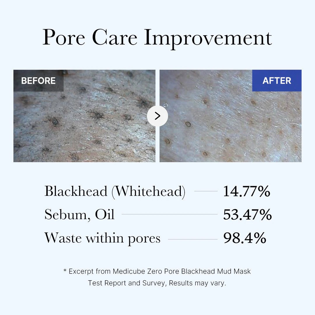 SKINCARE CORÉENNE masque zéro pore