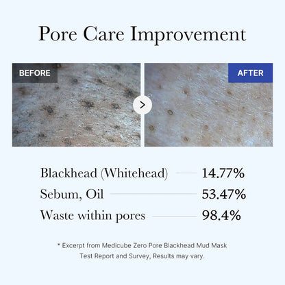 SKINCARE CORÉENNE masque zéro pore